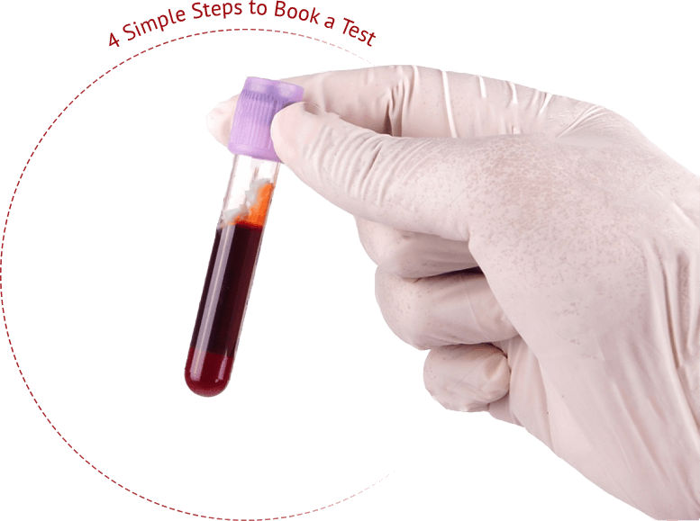 Test laboratory in Chandigarh MRI PET CT SCAN best pathology lab in